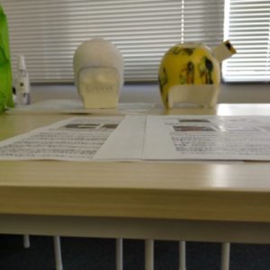 AHSスターバンドヘルメット治療の体験談｜トップページ