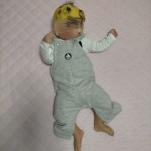 AHSスターバンドヘルメット治療の体験談｜トップページ