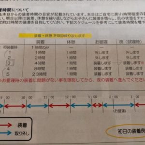 AHSスターバンドヘルメット治療87日目:右目のまぶた