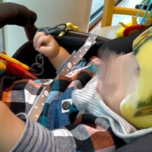 AHSスターバンドヘルメット治療の体験談｜トップページ