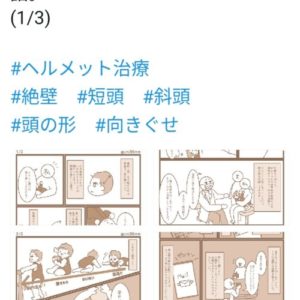 AHSスターバンドヘルメット治療の体験談｜トップページ